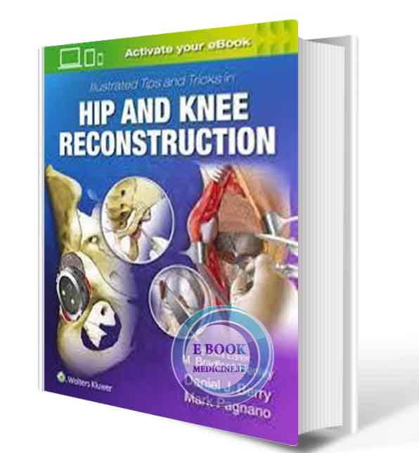 دانلود کتاب Illustrated Tips and Tricks in Hip and Knee Reconstructive and Replacement Surgery 1s 2019 ( PDF)